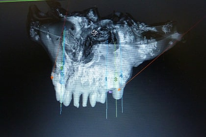 3D画像で正確な診断